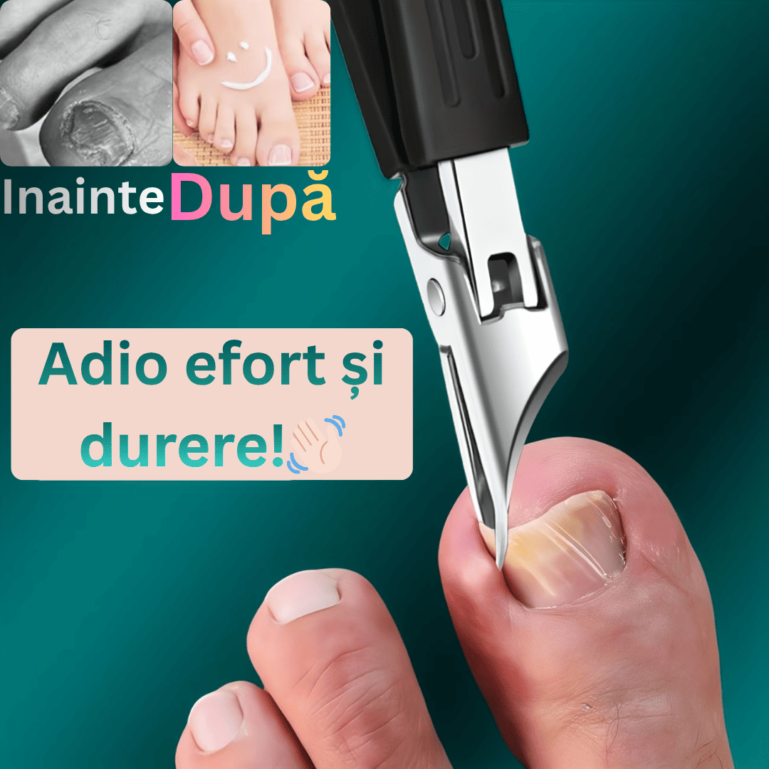 UnghieraPreciziei